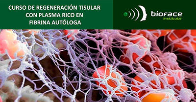 Regeneración Tisular con Plasma Rico en Fibrina Autóloga